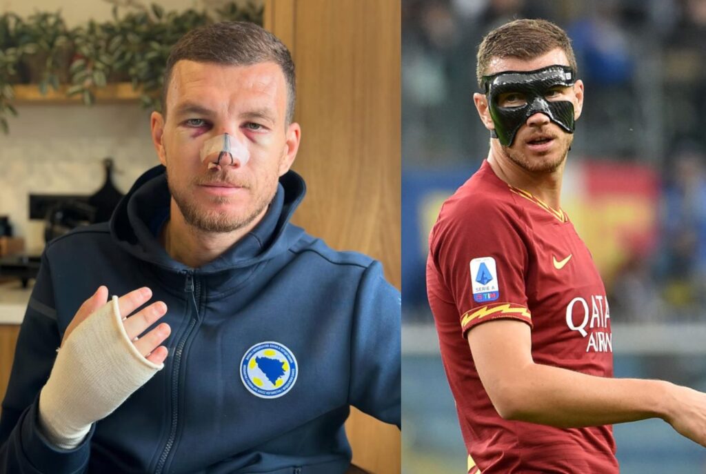 dzeko(1)